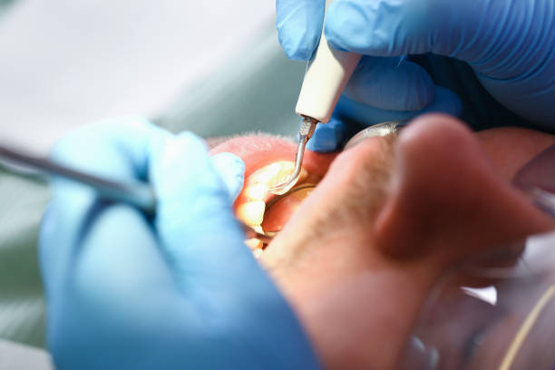 Best Mobile Emergency Dentist in Fairwood, WA