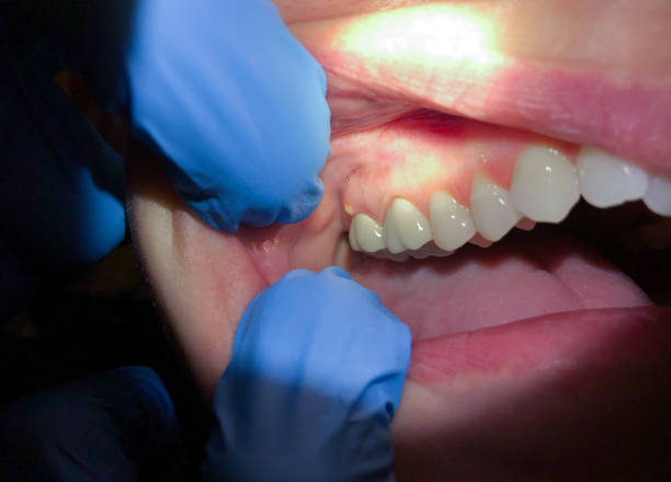 Best Pediatric Emergency Dentist in Fairwood, WA